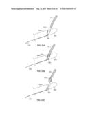 HEART VALVE CHORDAE REPLACEMENT METHODS AND APPARATUS diagram and image