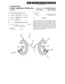 REPLACEMENT HEART VALVE diagram and image