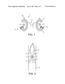 REPLACEMENT HEART VALVE diagram and image