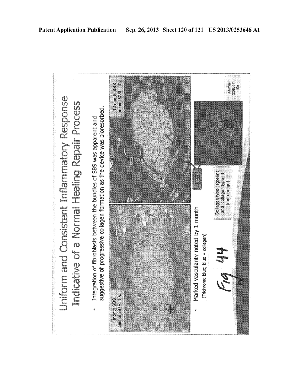 SILK BASED IMPLANTABLE MEDICAL DEVICES AND METHODS FOR DETERMINING     SUITABILITY FOR USE IN HUMANS - diagram, schematic, and image 121