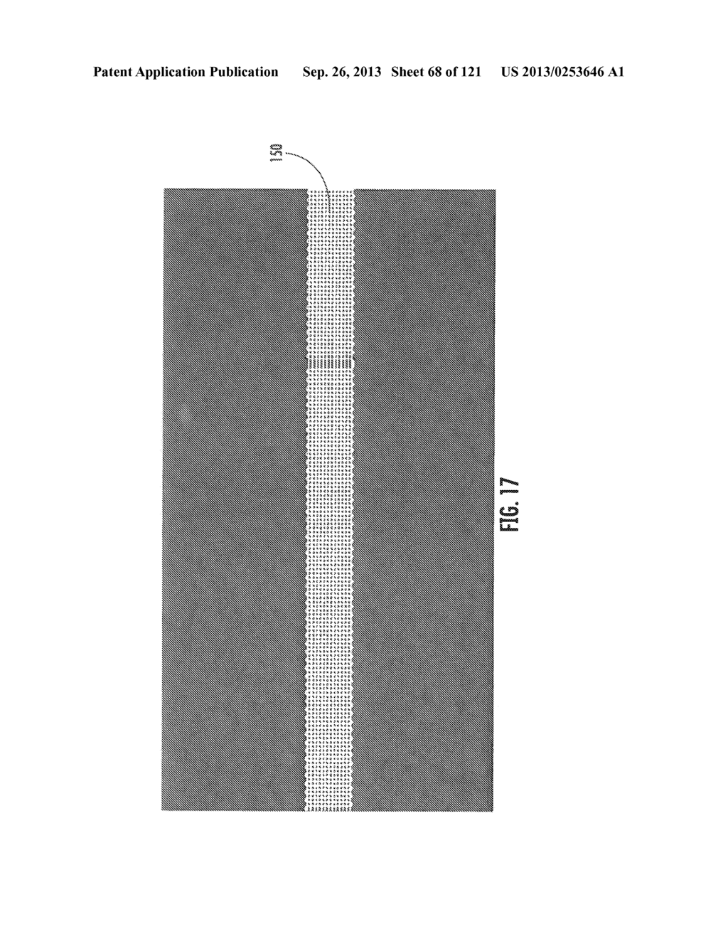 SILK BASED IMPLANTABLE MEDICAL DEVICES AND METHODS FOR DETERMINING     SUITABILITY FOR USE IN HUMANS - diagram, schematic, and image 69