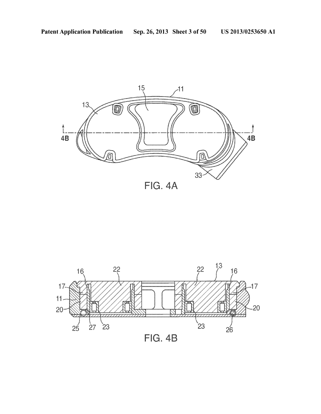 Adjustable Distraction Cage With Linked Locking Mechanisms - diagram, schematic, and image 04