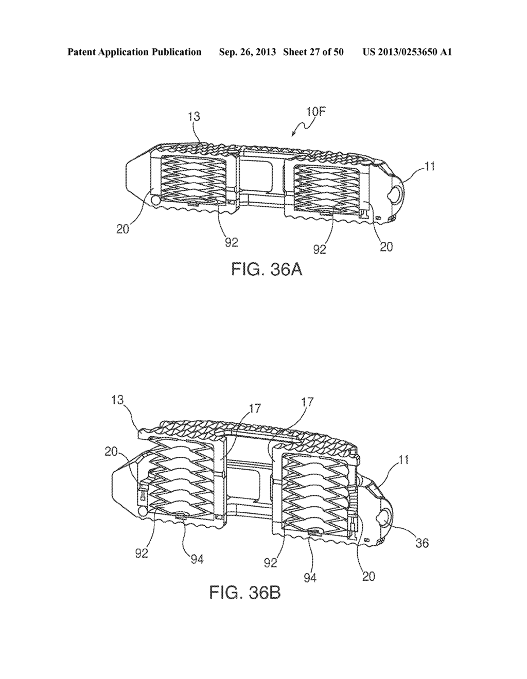 Adjustable Distraction Cage With Linked Locking Mechanisms - diagram, schematic, and image 28