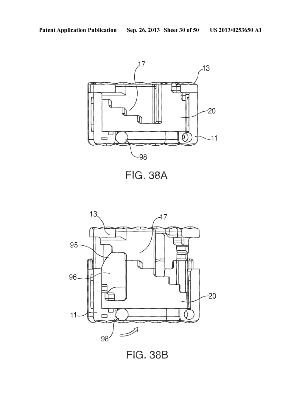 Adjustable Distraction Cage With Linked Locking Mechanisms - diagram, schematic, and image 31