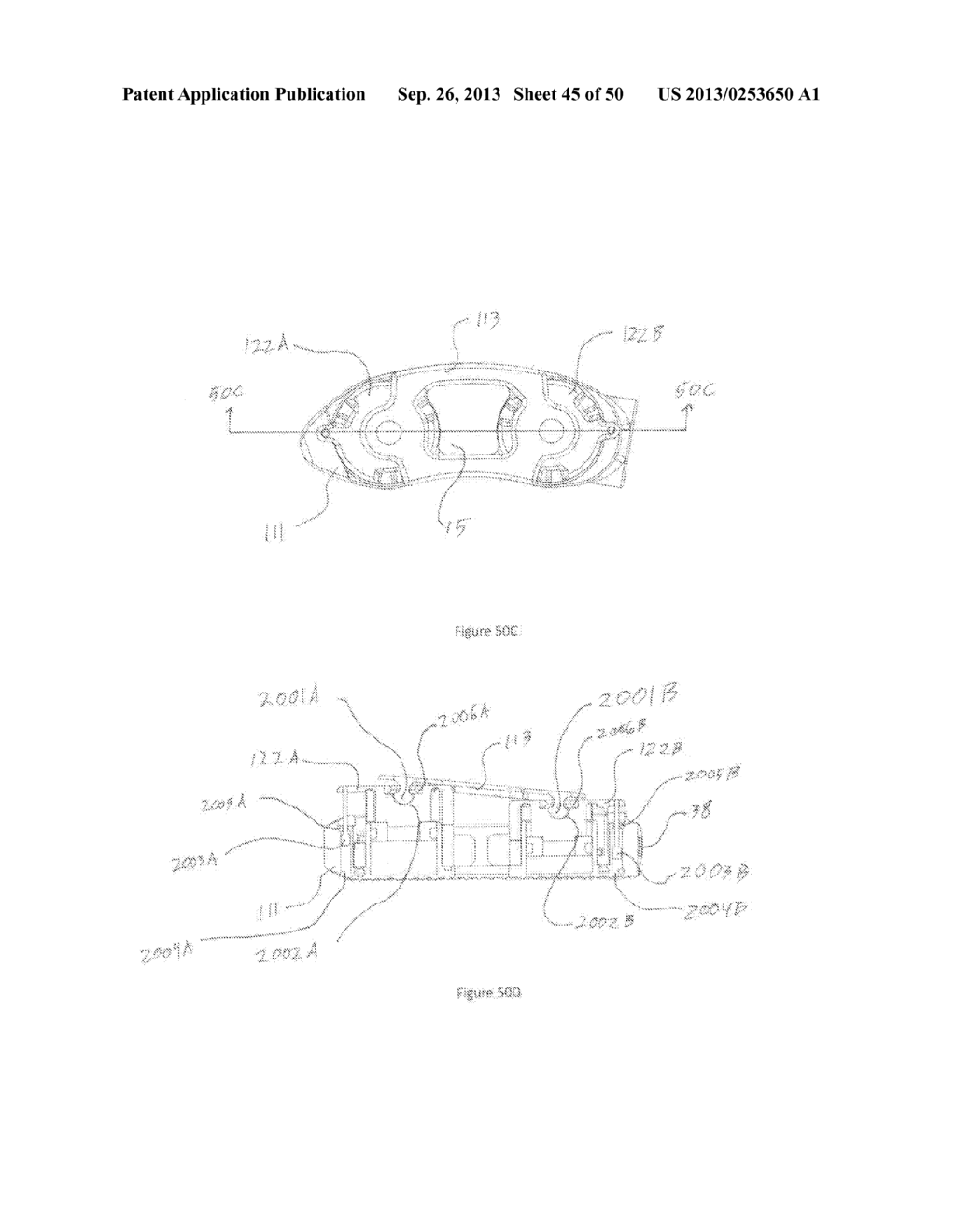 Adjustable Distraction Cage With Linked Locking Mechanisms - diagram, schematic, and image 46