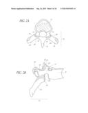 FLANGED INTERBODY FUSION DEVICE WITH FASTENER INSERT AND RETAINING RING diagram and image