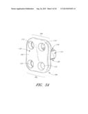 FLANGED INTERBODY FUSION DEVICE WITH FASTENER INSERT AND RETAINING RING diagram and image