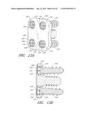 FLANGED INTERBODY FUSION DEVICE WITH FASTENER INSERT AND RETAINING RING diagram and image