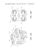 FLANGED INTERBODY FUSION DEVICE WITH FASTENER INSERT AND RETAINING RING diagram and image