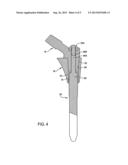 MODULAR FEMORAL STEM COMPONENT FOR A HIP JOINT PROSTHESIS diagram and image