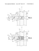 Intramedullary Rod Implantation System diagram and image