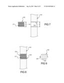 Intramedullary Rod Implantation System diagram and image