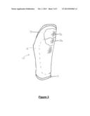 Limb Shield diagram and image