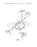 Weighted Support for a Pet Chew Article diagram and image