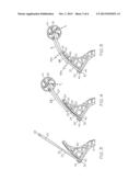 Archery Bow Limb Support diagram and image