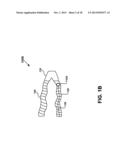 DISPOSABLE RESPIRATORY CIRCUIT COUPLED WITH A DISPOSABLE TEMPERATURE     SENSOR diagram and image