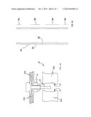 HOLLOW ARTICLE OF VARIABLE WALL STRUCTURE DENSITY diagram and image