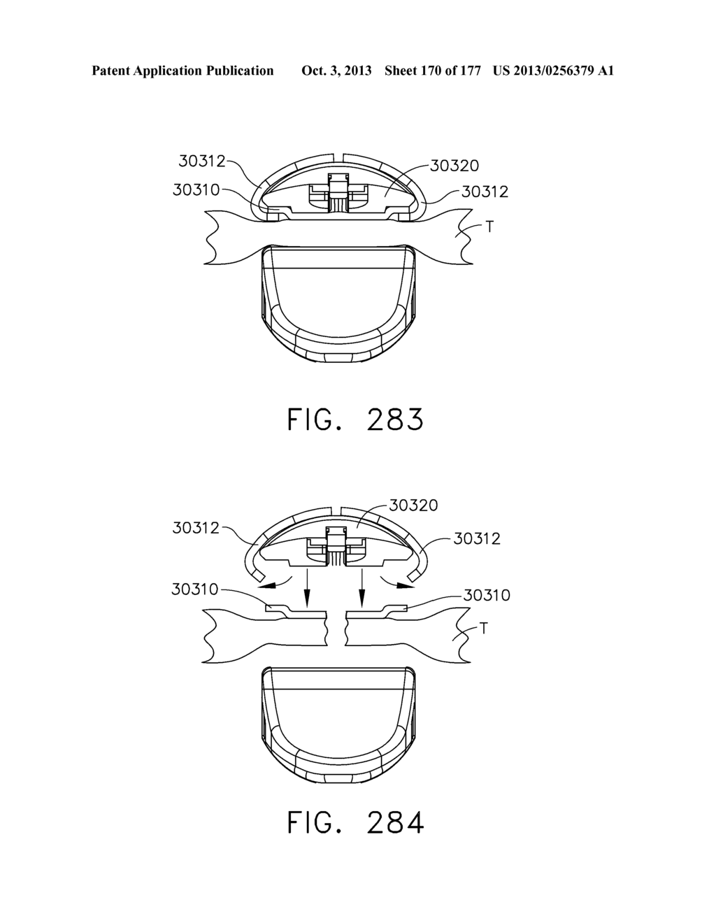 SURGICAL STAPLING CARTRIDGE WITH LAYER RETENTION FEATURES - diagram, schematic, and image 171