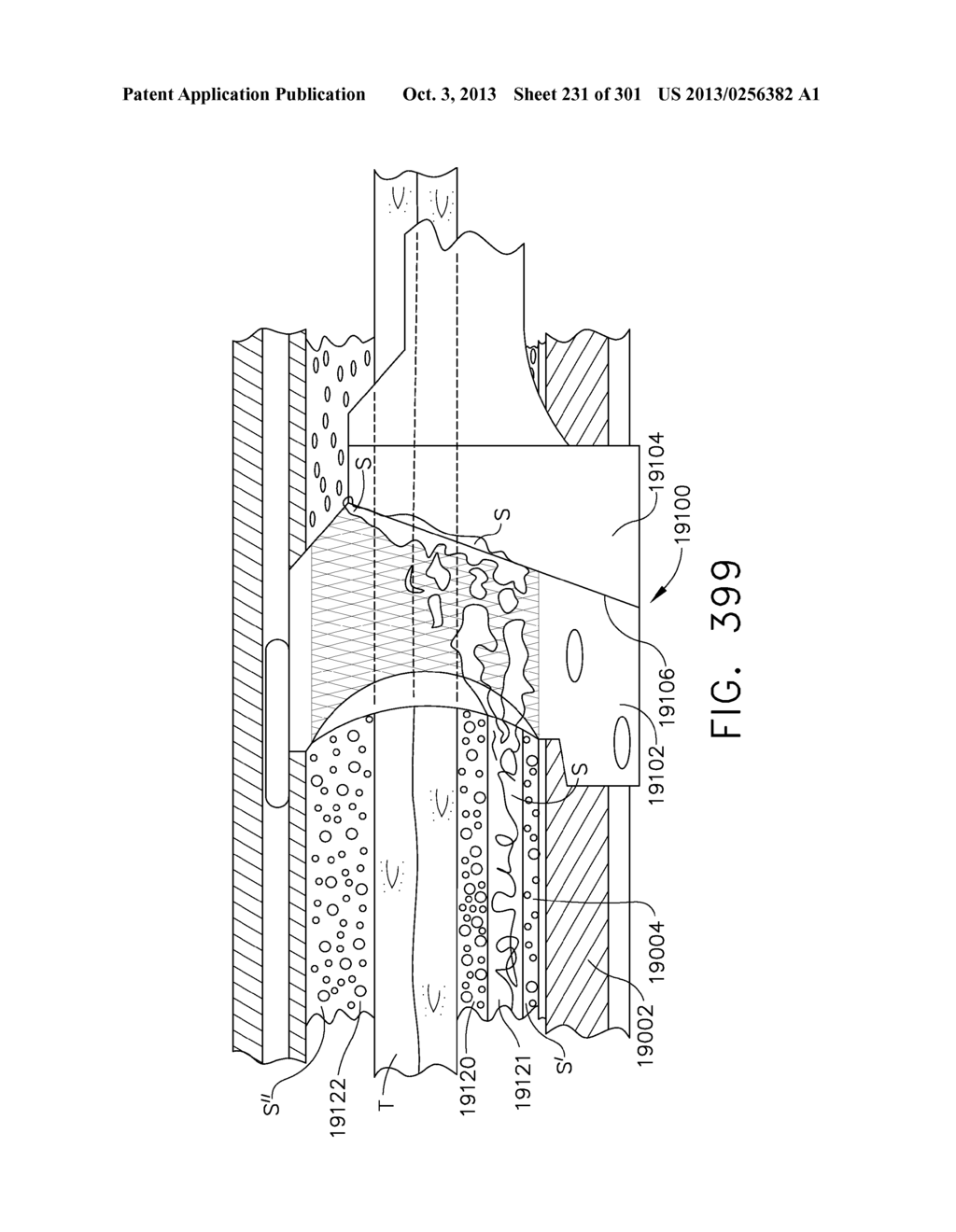 MOVABLE MEMBER FOR USE WITH A TISSUE THICKNESS COMPENSATOR - diagram, schematic, and image 232