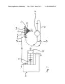 Hydraulic Milling Ball Feed And Discharge For Stirred Ball Mills diagram and image