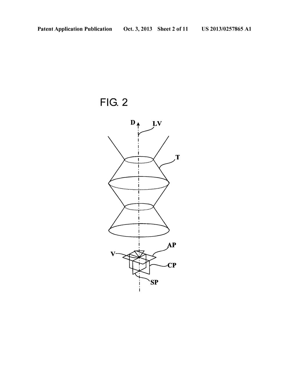 MEDICAL IMAGE PROCESSING APPARATUS AND MEDICAL IMAGE DIAGNOSIS APPARATUS - diagram, schematic, and image 03