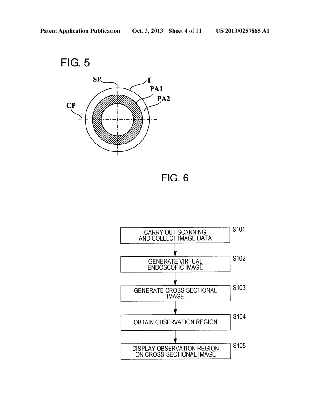 MEDICAL IMAGE PROCESSING APPARATUS AND MEDICAL IMAGE DIAGNOSIS APPARATUS - diagram, schematic, and image 05