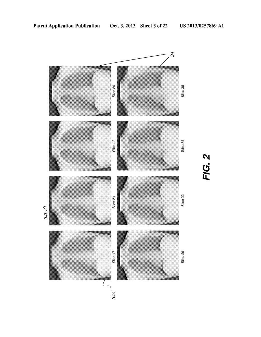 METHOD FOR ENHANCING RECONSTRUCTED 3-D TOMOSYNTHESIS VOLUME IMAGE - diagram, schematic, and image 04