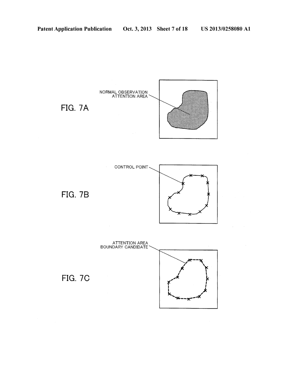 ENDOSCOPIC IMAGE PROCESSING DEVICE, INFORMATION STORAGE DEVICE AND IMAGE     PROCESSING METHOD - diagram, schematic, and image 08