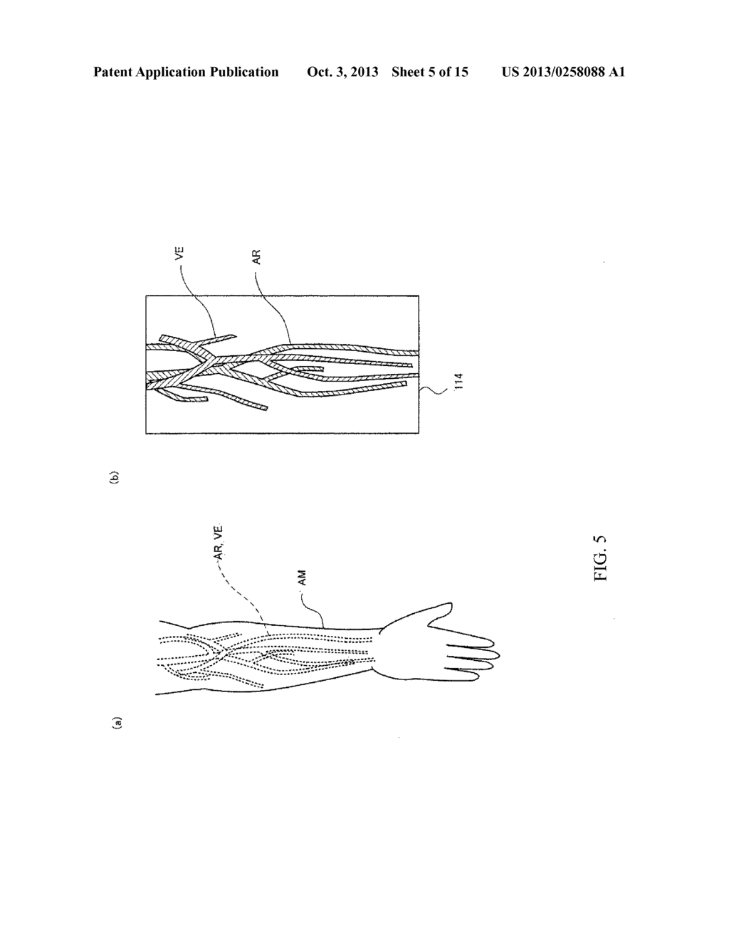 BLOOD VESSEL DISPLAY DEVICE - diagram, schematic, and image 06