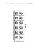 COMPUTER AIDED DIAGNOSTIC SYSTEM INCORPORATING SHAPE ANALYSIS FOR     DIAGNOSING MALIGNANT LUNG NODULES diagram and image