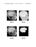 COMPUTER AIDED DIAGNOSTIC SYSTEM INCORPORATING 3D SHAPE ANALYSIS OF THE     BRAIN FOR IDENTIFYING DEVELOPMENTAL BRAIN DISORDERS diagram and image