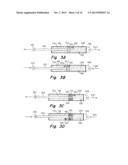 Stiff Link Thumb with Dampener diagram and image