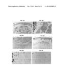 FULLY HUMAN ANTIBODIES TO HIGH MOLECULAR WEIGHT-MELANOMA ASSOCIATED     ANTIGEN AND USES THEREOF diagram and image