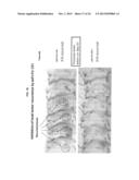 FULLY HUMAN ANTIBODIES TO HIGH MOLECULAR WEIGHT-MELANOMA ASSOCIATED     ANTIGEN AND USES THEREOF diagram and image