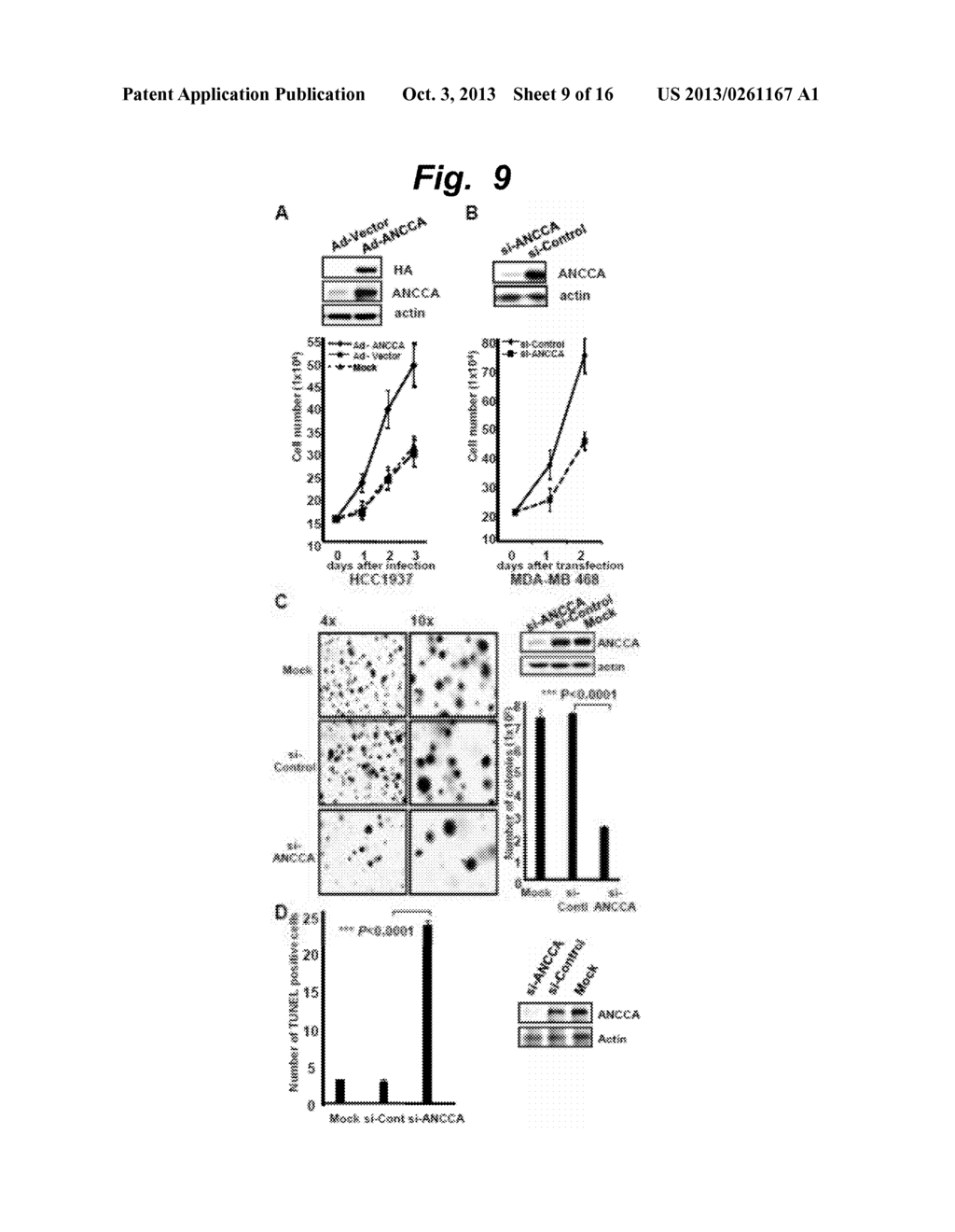 ANCCA as a Diagnostic Biomarker and Therapeutic Target for Breast Cancers - diagram, schematic, and image 10