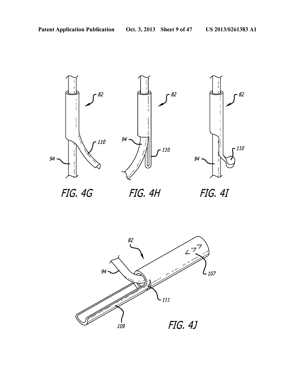 APPARATUS AND METHOD FOR MANIPULATING OR RETRACTING TISSUE AND ANATOMICAL     STRUCTURE - diagram, schematic, and image 10