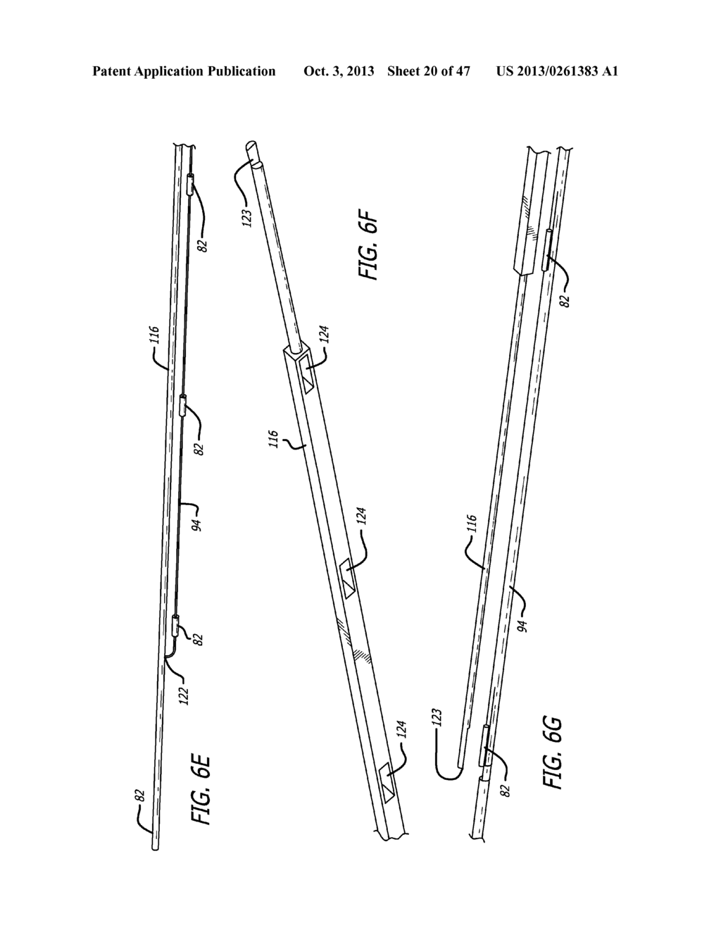 APPARATUS AND METHOD FOR MANIPULATING OR RETRACTING TISSUE AND ANATOMICAL     STRUCTURE - diagram, schematic, and image 21