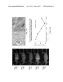 PHOTOTHERMAL NANOSTRUCTURES IN TUMOR THERAPY diagram and image