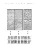 PHOTOTHERMAL NANOSTRUCTURES IN TUMOR THERAPY diagram and image