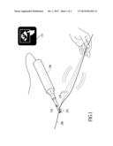 Sonic Endovenous Catheter diagram and image