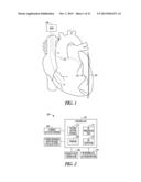 BASELINE DETERMINATION FOR PHRENIC NERVE STIMULATION DETECTION diagram and image