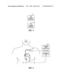 BASELINE DETERMINATION FOR PHRENIC NERVE STIMULATION DETECTION diagram and image