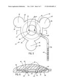 INTRACRANIAL SENSING & MONITORING DEVICE WITH MACRO AND MICRO ELECTRODES diagram and image