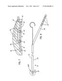 INTRACRANIAL SENSING & MONITORING DEVICE WITH MACRO AND MICRO ELECTRODES diagram and image