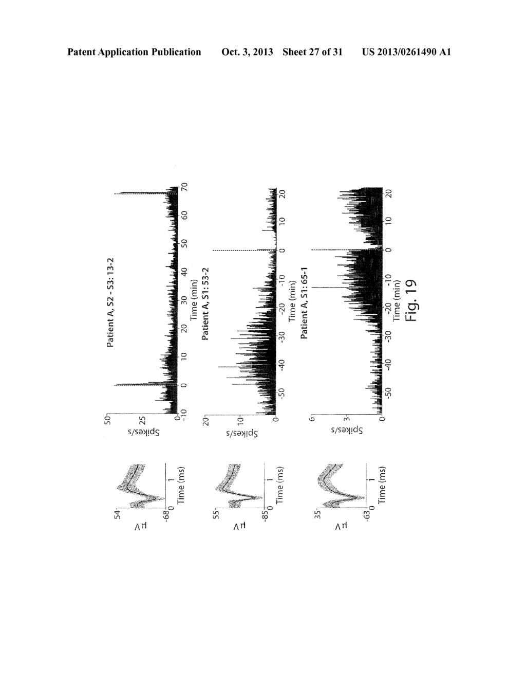 Methods for Prediction and Early Detection of Neurological Events - diagram, schematic, and image 28