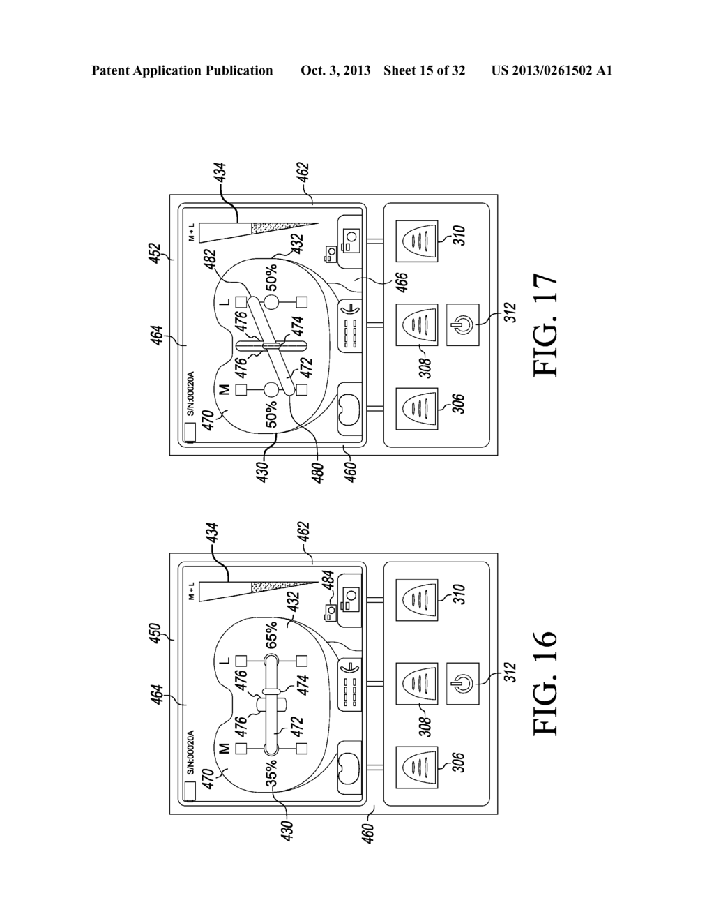 ORTHOPAEDIC SENSOR MODULE AND SYSTEM FOR DETERMINING JOINT FORCES OF A     PATIENT'S KNEE JOINT - diagram, schematic, and image 16