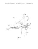 TIBIAL PROSTHESIS SYSTEMS, KITS, AND METHODS diagram and image