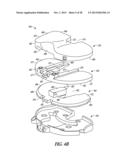 TIBIAL PROSTHESIS SYSTEMS, KITS, AND METHODS diagram and image