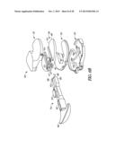 TIBIAL PROSTHESIS SYSTEMS, KITS, AND METHODS diagram and image