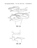 TIBIAL PROSTHESIS SYSTEMS, KITS, AND METHODS diagram and image